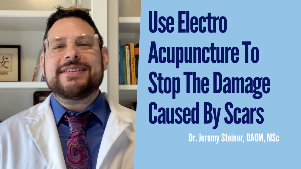Use Electro Acupuncture To Stop The Damage Caused By Scars