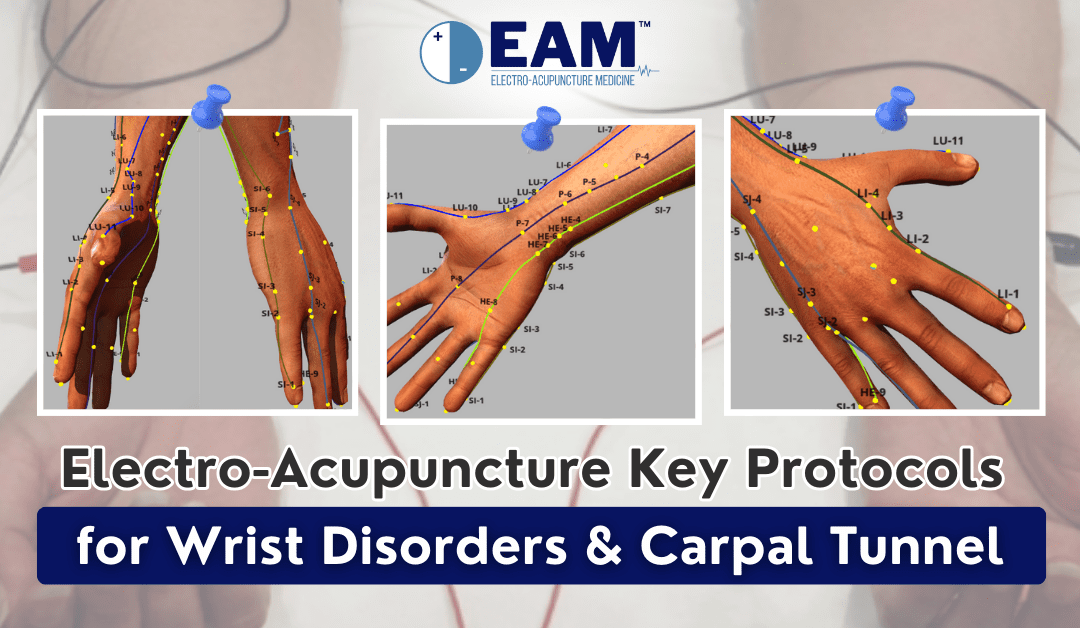 Electro-Acupuncture Key Protocols for Wrist Disorders & Carpal Tunnel
